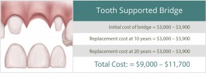 945_tooth-supported-bridge-1024x363